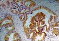 Anti-PSA antibody [A67-B/E3] used in IHC (Paraffin sections) (IHC-P). GTX22218