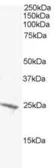 Anti-BAK antibody used in Western Blot (WB). GTX22273