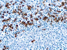 Rabbit Anti-Human IgG antibody. GTX22410