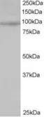 Anti-MAP4K1 antibody, N-term used in Western Blot (WB). GTX22646