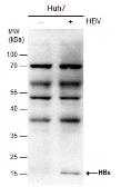Anti-Hepatitis B virus X protein antibody [X36C] used in Western Blot (WB). GTX22741