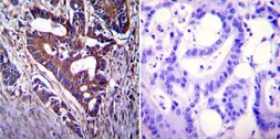 Anti-CFTR antibody [CF3] used in IHC (Paraffin sections) (IHC-P). GTX22784