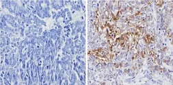 Anti-Galectin 3 antibody [A3A12] used in IHC (Paraffin sections) (IHC-P). GTX22785