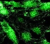 Anti-alpha Adaptin antibody [AC1-M11] used in Immunocytochemistry/ Immunofluorescence (ICC/IF). GTX22807