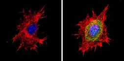 Anti-PSMB6 antibody used in Immunocytochemistry/ Immunofluorescence (ICC/IF). GTX23331