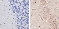 Anti-Adenosine A1 Receptor antibody used in IHC (Paraffin sections) (IHC-P). GTX23460