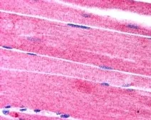 Anti-SORBS1 antibody, C-term used in IHC (Paraffin sections) (IHC-P). GTX24551