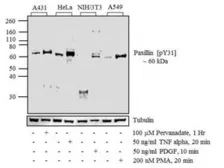 Anti-Paxillin (phospho Tyr31) antibody used in Western Blot (WB). GTX24832