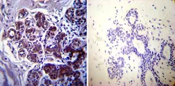 Anti-Hsp70 antibody [4G4] used in IHC (Paraffin sections) (IHC-P). GTX25444