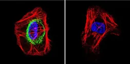Anti-TSH receptor antibody [49] used in Immunocytochemistry/ Immunofluorescence (ICC/IF). GTX25492