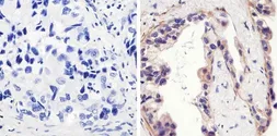 Anti-EGFR (phospho Tyr1173) antibody used in IHC (Paraffin sections) (IHC-P). GTX25652
