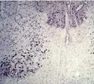 Anti-Parkin antibody used in IHC (Paraffin sections) (IHC-P). GTX25667