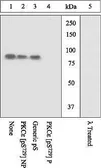 Anti-PKC epsilon (phospho Ser729) antibody used in Western Blot (WB). GTX25811