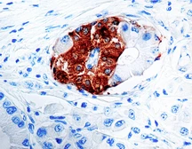 Anti-Synaptophysin antibody [SYP02] used in IHC (Paraffin sections) (IHC-P). GTX26245