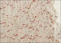 Anti-pan Cadherin antibody [CH-19] used in IHC (Paraffin sections) (IHC-P). GTX26528