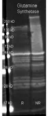 Anti-Glutamine Synthetase antibody used in Western Blot (WB). GTX26585