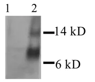 Anti-MCP1 / CCL2 antibody used in Western Blot (WB). GTX27202