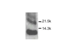 Anti-CXCL10 / IP10 antibody used in Western Blot (WB). GTX27206