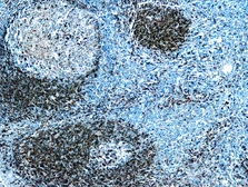 Anti-CD79a antibody [HM47/A9] (ready-to-use) used in IHC (Paraffin sections) (IHC-P). GTX27491