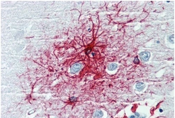 Anti-GFAP antibody [GF-01] used in IHC (Paraffin sections) (IHC-P). GTX27806