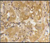 Anti-Bim antibody used in Immunohistochemistry (IHC). GTX27888