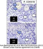 Anti-p27 Kip1 antibody used in Immunohistochemistry (IHC). GTX27961