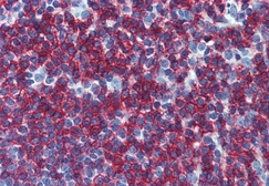 Anti-CD45RB antibody [MEM-55] used in IHC (Paraffin sections) (IHC-P). GTX28218