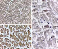 Anti-PPAR delta antibody used in Immunohistochemistry (IHC). GTX28937