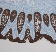 Anti-Cytokeratin 8 antibody [RCK106] used in IHC (Paraffin sections) (IHC-P). GTX29219