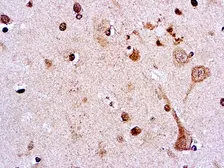 Anti-Pneumocystis carinii antibody [3F6] used in IHC (Paraffin sections) (IHC-P). GTX29531