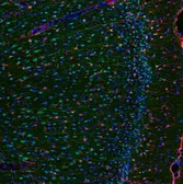 Anti-IL6 antibody used in IHC (Paraffin sections) (IHC-P). GTX29770