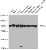 Anti-Annexin VI antibody used in Western Blot (WB). GTX30050