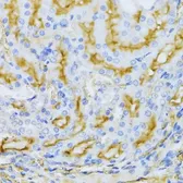 Anti-ARF6 antibody used in IHC (Paraffin sections) (IHC-P). GTX30062
