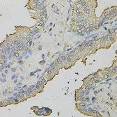 Anti-AZGP1 antibody used in IHC (Paraffin sections) (IHC-P). GTX30081