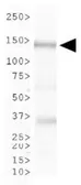 Anti-CHAF1A antibody [SS 1 1-13] used in Western Blot (WB). GTX30243