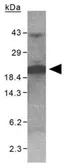 Anti-XAGE1 antibody used in Western Blot (WB). GTX30362