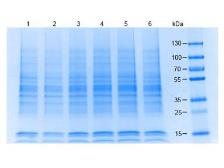 Jurkat whole cell lysate. GTX30596