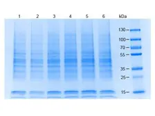 Jurkat whole cell lysate. GTX30596