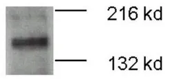 Anti-ATP7b antibody used in Western Blot (WB). GTX30639