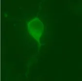 Anti-LRRK2 antibody used in Immunocytochemistry/ Immunofluorescence (ICC/IF). GTX30678