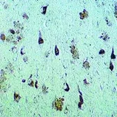 Anti-Neurofibrillary Tangles antibody used in IHC (Paraffin sections) (IHC-P). GTX31067
