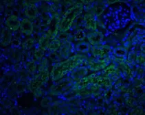 Anti-DcR2 / CD264 antibody used in IHC (Paraffin sections) (IHC-P). GTX31258