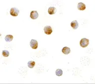 Anti-DFFB antibody used in Immunocytochemistry/ Immunofluorescence (ICC/IF). GTX31262