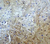 Anti-SLITRK1 antibody used in IHC (Paraffin sections) (IHC-P). GTX31333