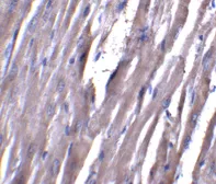 Anti-ASAH1 antibody used in IHC (Paraffin sections) (IHC-P). GTX31356
