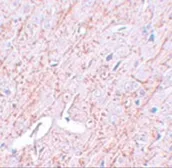 Anti-GATA3 antibody used in IHC (Paraffin sections) (IHC-P). GTX31401