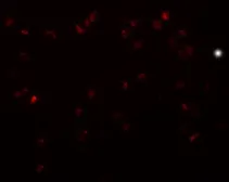 Anti-TRIP6 antibody used in Immunocytochemistry/ Immunofluorescence (ICC/IF). GTX31421