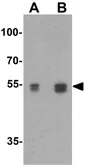 Anti-Serine palmitoyltransferase 2 antibody used in Western Blot (WB). GTX31437