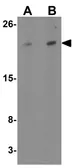 Anti-Transmembrane protein 147 antibody used in Western Blot (WB). GTX31452