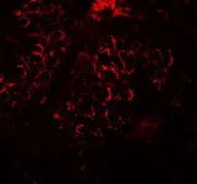 Anti-DCP2 antibody used in IHC (Paraffin sections) (IHC-P). GTX31499
